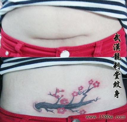 剖腹产纹身 纹身可以遮盖疤痕吗?武汉龙刺堂文身